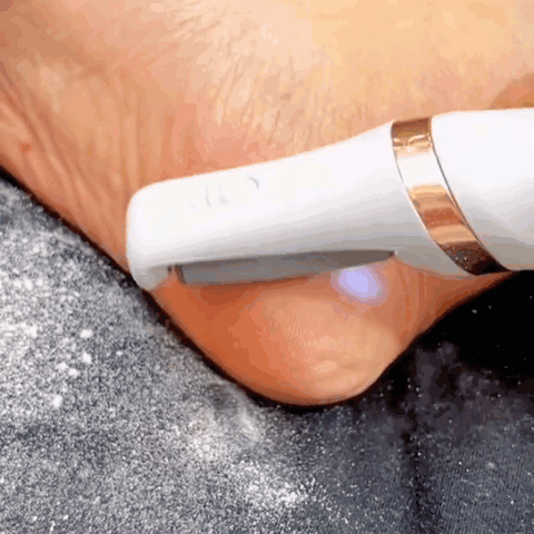 Flawless Pedi Callus Remover – Shoppers Town