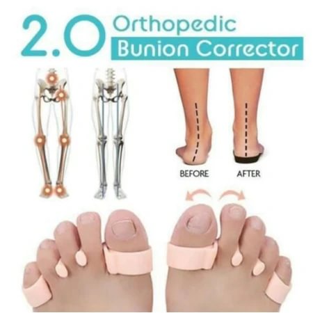orthopedic bunion corrector 2 1